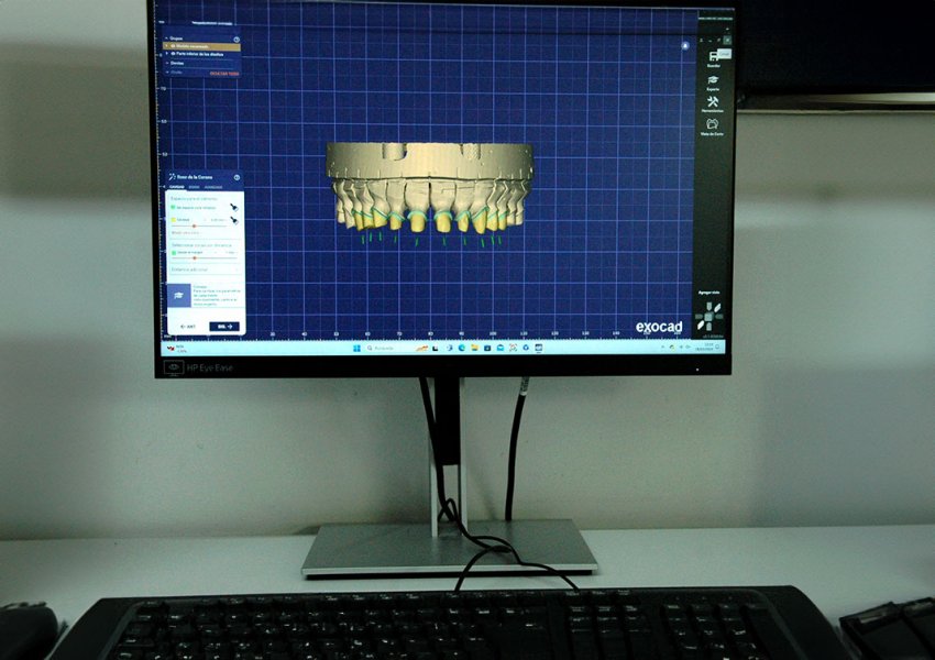 Sistema CAD/CAM